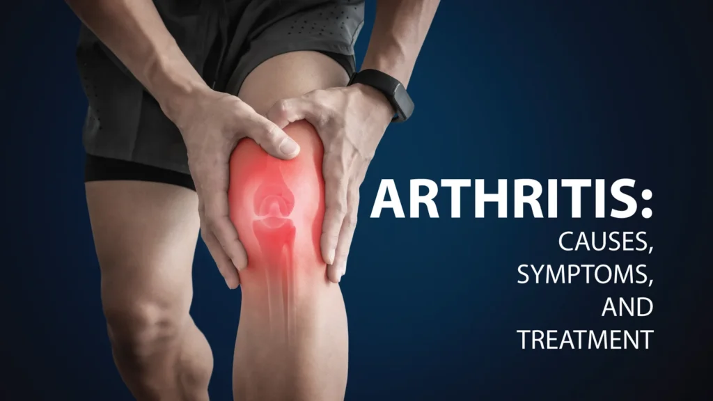Attrities Uncovered: A Real-Talk Guide to Arthritis in 2026