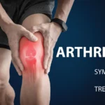Attrities Uncovered: A Real-Talk Guide to Arthritis in 2026