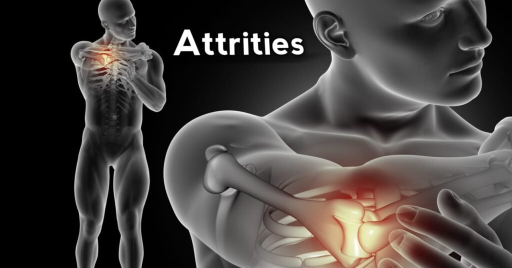 Attrities: Unraveling the Mystery of Joint Pain and Inflammation