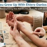 23 Signs You Grew Up With Ehlers-Danlos Syndrome – Attrities